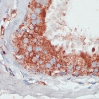 Anti-PGK2 Antibody
