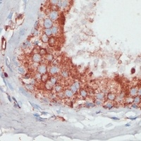 PGK2 antibody