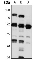 PGM 2 Rabbit Polyclonal Antibody
