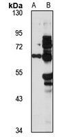 PGM 3 Rabbit Polyclonal Antibody