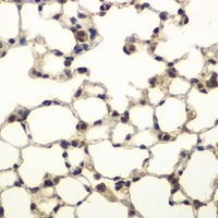 Anti-PHF11 Antibody