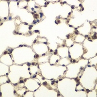 PHF11 antibody