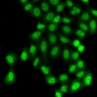 PHF11 antibody