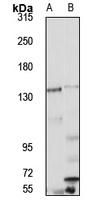 PHKA1 Antibody