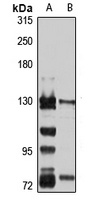 PHKA2 Rabbit Polyclonal Antibody