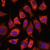 PI 4-kinase beta Rabbit Polyclonal Antibody
