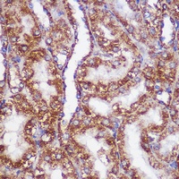 Anti-PIG-M Antibody