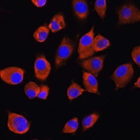 Anti-PIG-M Antibody