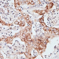 PIGR antibody