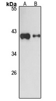 NOP17 Rabbit Polyclonal Antibody