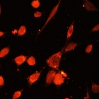 PI3K p85 gamma Rabbit Polyclonal Antibody