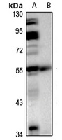 PI3K p85 gamma Rabbit Polyclonal Antibody