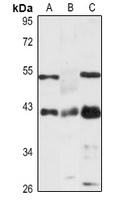Pim-1 Rabbit Polyclonal Antibody
