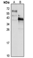 Pim-2 Rabbit Polyclonal Antibody