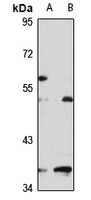 PISD Antibody