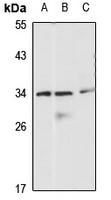PITX3 Rabbit Polyclonal Antibody