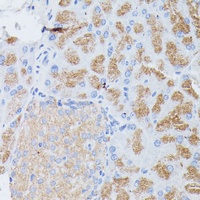 PLA2G1B antibody