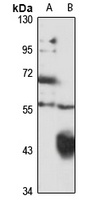 PLA2G3 Rabbit Polyclonal Antibody