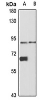 PLAP Rabbit Polyclonal Antibody