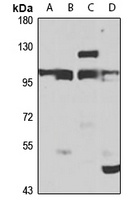 PLC delta 4 Rabbit Polyclonal Antibody