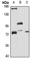 PLOD3 Rabbit Polyclonal Antibody