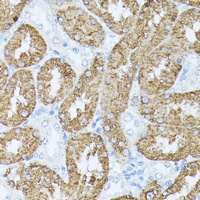 Anti-I-plastin Antibody