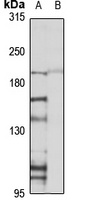 Plexin B1 Antibody