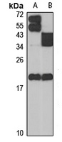 MCH Rabbit Polyclonal Antibody