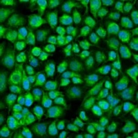 Anti-PNKD Antibody