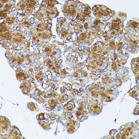 Anti-PLRP1 Antibody