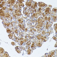 PLRP1 antibody