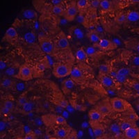 Anti-PLRP1 Antibody