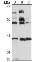 MA1 Rabbit Polyclonal Antibody