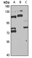 POLK Rabbit Polyclonal Antibody