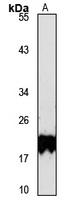 POP5 Rabbit Polyclonal Antibody