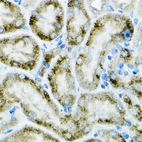 Anti-PGC1 alpha Antibody