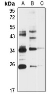 PPC Synthetase Rabbit Polyclonal Antibody