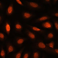 Anti-PPIL4 Antibody