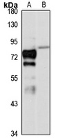 PP2C-gamma Rabbit Polyclonal Antibody