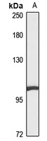 MYPT2 Rabbit Polyclonal Antibody