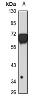 PPP3CB Rabbit Polyclonal Antibody