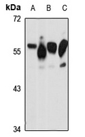 PP5 Rabbit Polyclonal Antibody