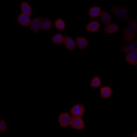 PP5 antibody