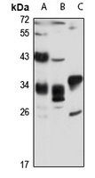 PP6 Antibody