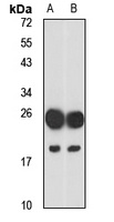 MBPH Rabbit Polyclonal Antibody