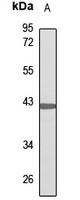 PKA C alpha Rabbit Polyclonal Antibody