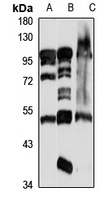 PRKRIR Antibody