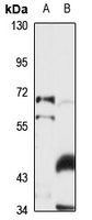 Prolactin Receptor Rabbit Polyclonal Antibody