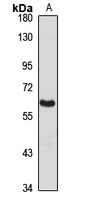 PRMT3 Rabbit Polyclonal Antibody