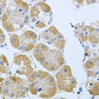 Prokineticin-2 Rabbit Polyclonal Antibody
